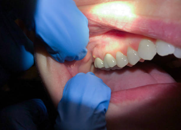 Best Emergency Treatment for Toothache in Steep Falls, ME